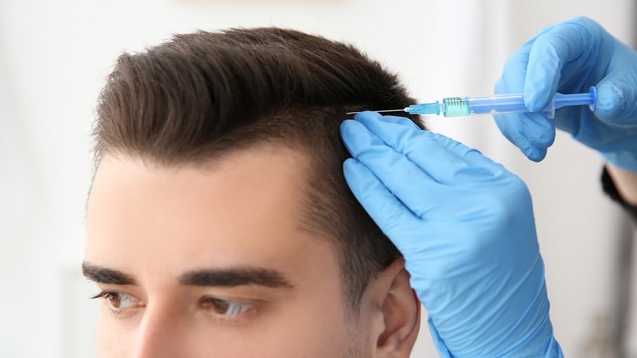 PRP Hair Treatment Dubai